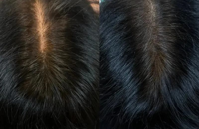 Female Scalp Micropigmentation Cost 2026 | Queens Guide — Therapeutic Cuts Women's SMP guide card image
