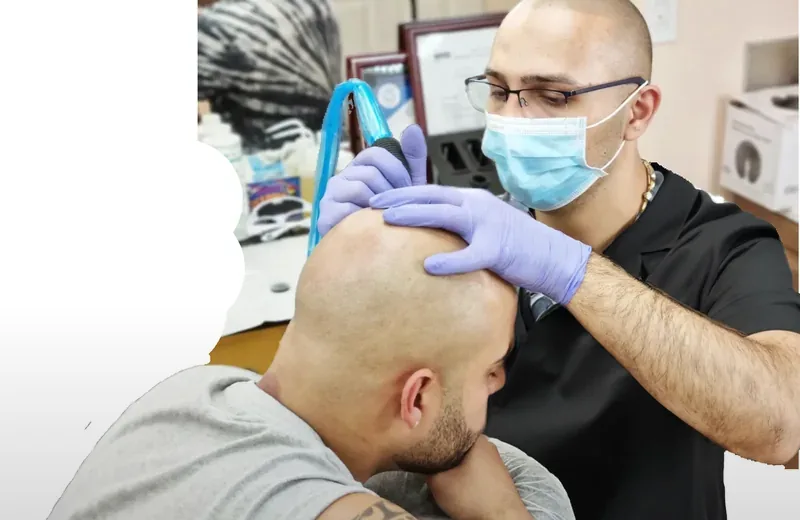 Scalp Micropigmentation NYC 2026: Complete Guide to SMP in New York — Therapeutic Cuts NYC Guide guide card image