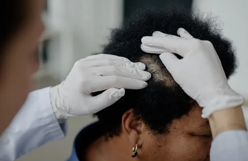 Scalp Micropigmentation Removal Cost 2026 | Therapeutic Cuts NYC — Therapeutic Cuts SMP Removal guide card image