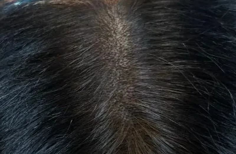 SMP for Women 2026: Complete Queens NYC Guide | Therapeutic Cuts — Therapeutic Cuts SMP Women guide card image