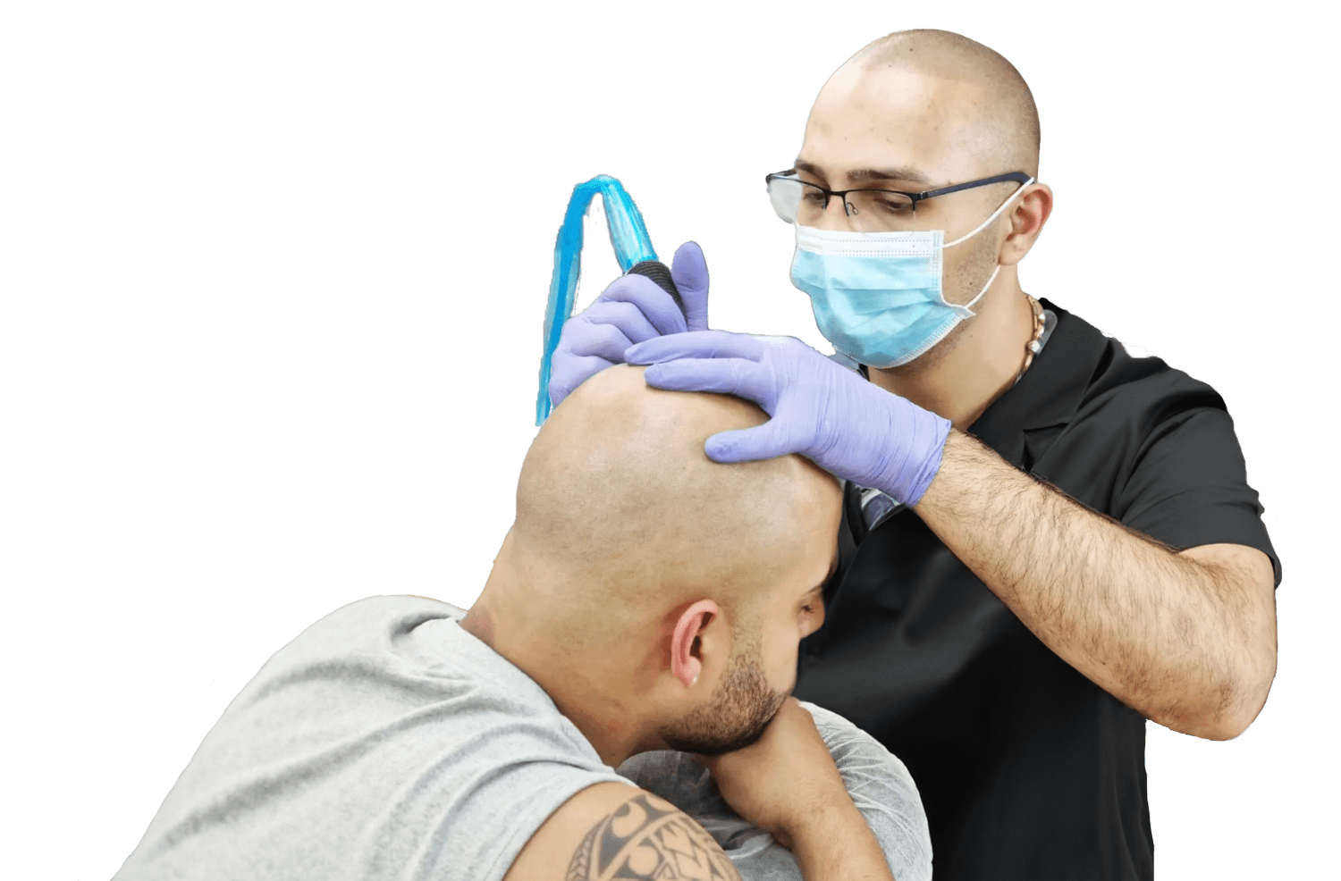 Scalp Micropigmentation